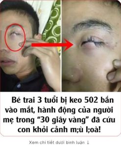 Bé trai 3 tuổi bị keo 502 bắn vào mắt, hành động của người mẹ trong “30 giây vàng” đã cứu con khỏi cảnh m;ù l;oà!